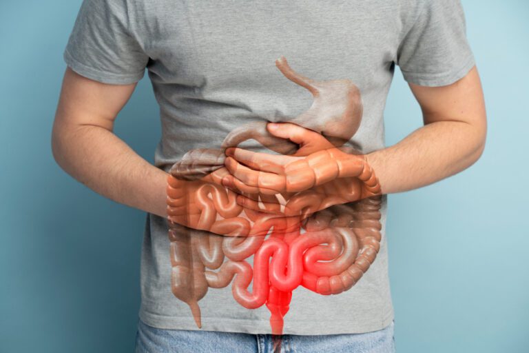 doenca de crohn