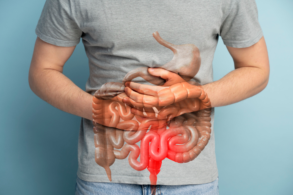 Doença de Crohn: o que é, quais são os sintomas