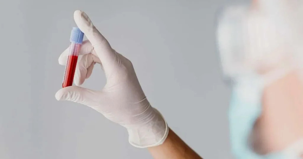 Profissional de saúde segurando tubo de ensaio com amostra de sangue, representando exames para investigar disbiose intestinal.