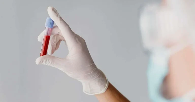 Profissional de saúde segurando tubo de ensaio com amostra de sangue, representando exames para investigar disbiose intestinal.