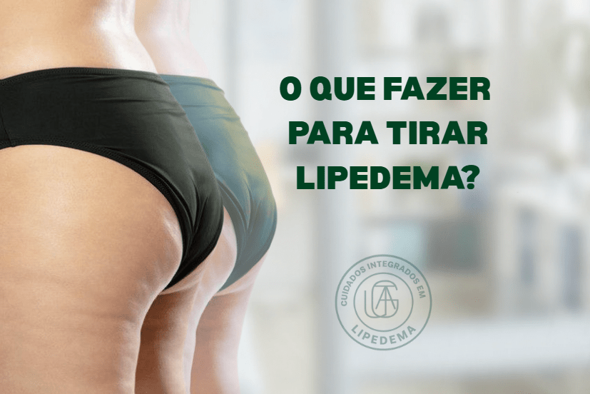 O que fazer para tirar lipedema?