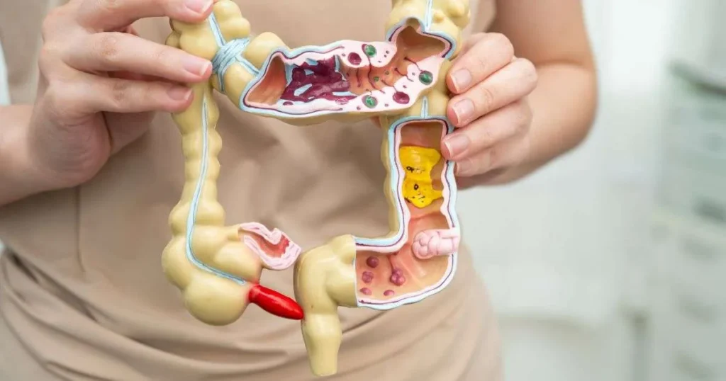 Pessoa segurando modelo anatômico do intestino grosso com corte transversal mostrando estruturas internas coloridas