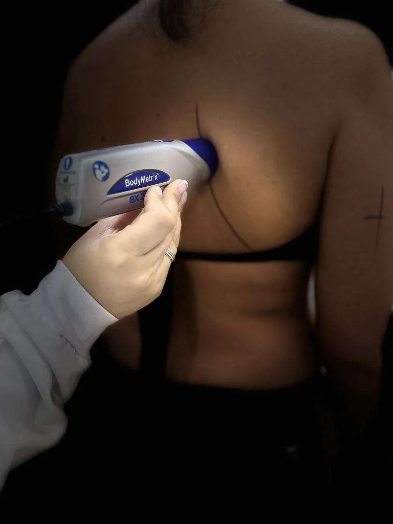 Avaliação Física por Ultrassonografia BodyMetrix